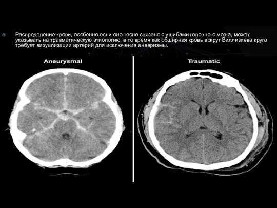 Распределение крови, особенно если оно тесно связано с ушибами головного мозга, может