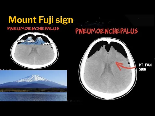 Mount Fuji sign