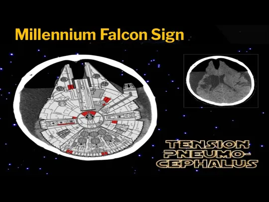 Millennium Falcon Sign