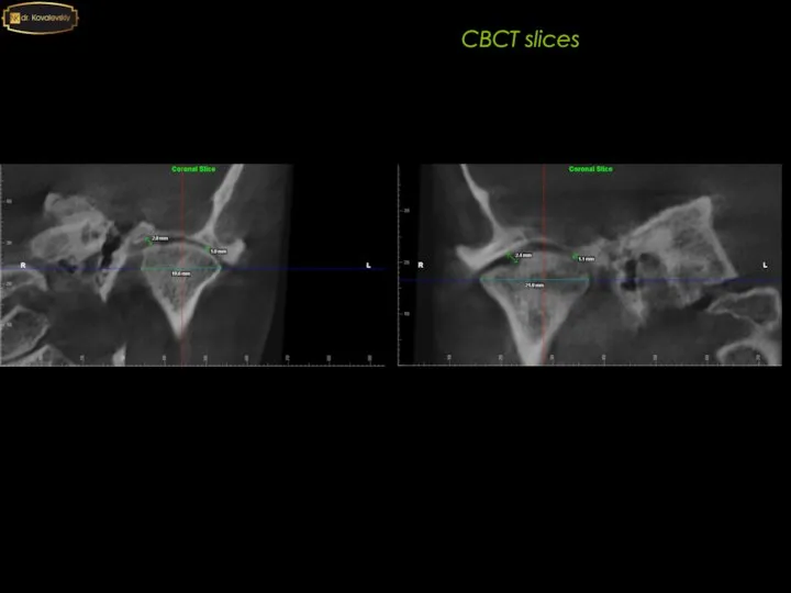CBCT slices