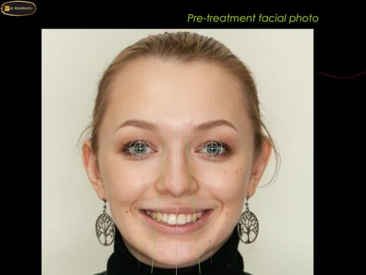 Pre-treatment facial photo