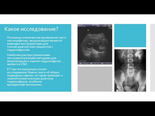 Какое исследование? Поскольку клинические проявления часто неспецифичны, визуализация является важными инструментами для