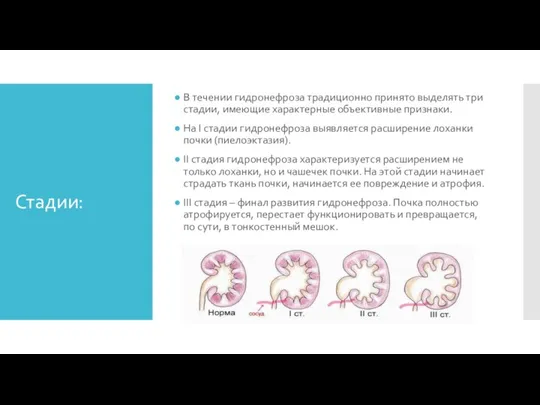 Стадии: В течении гидронефроза традиционно принято выделять три стадии, имеющие характерные объективные