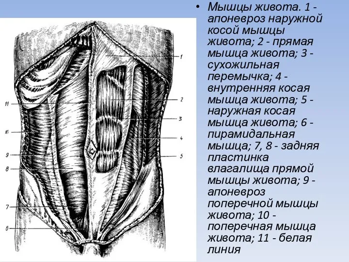 Мышцы живота. 1 - апоневроз наружной косой мышцы живота; 2 - прямая