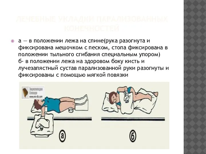 ЛЕЧЕБНЫЕ УКЛАДКИ ПАРАЛИЗОВАННЫХ КОНЕЧНОСТЕЙ а — в положении лежа на спине(рука разогнута