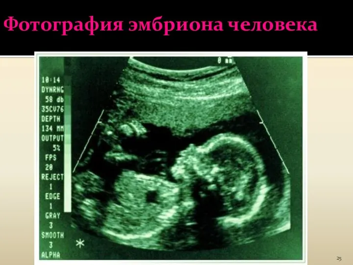 Фотография эмбриона человека