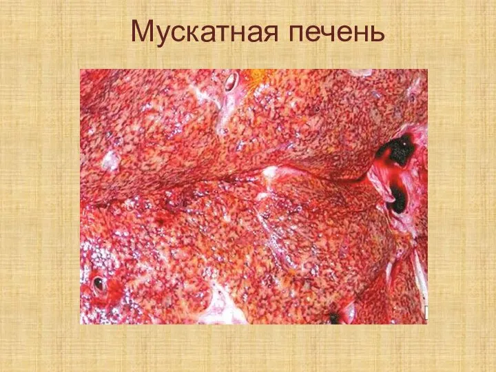 Мускатная печень