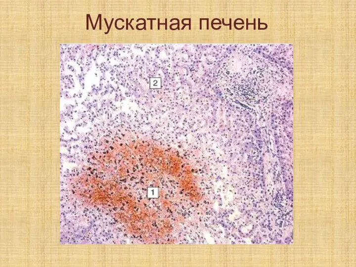 Мускатная печень