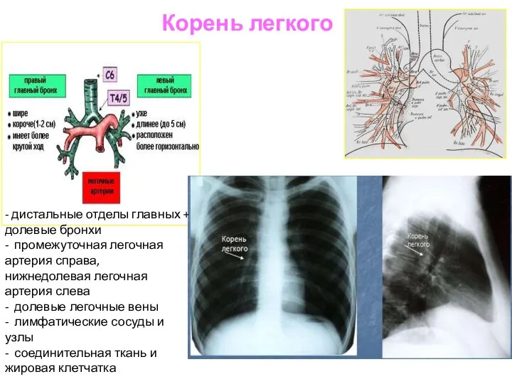 Корень легкого - дистальные отделы главных + долевые бронхи - промежуточная легочная