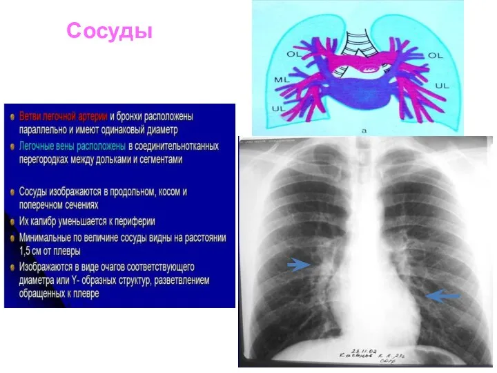 Сосуды