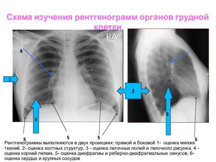 Схема изучения рентгенограмм органов грудной клетки 1 2 3 3 4 4