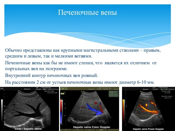 Обычно представлены как крупными магистральными стволами – правым, средним и левым, так