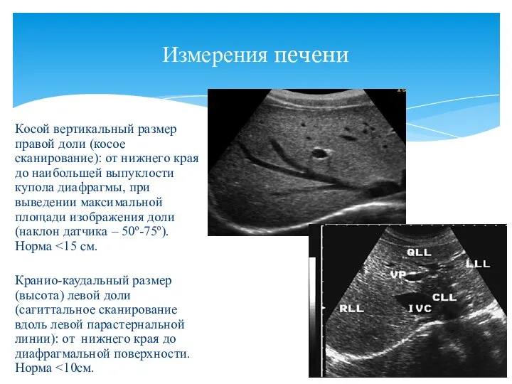 Косой вертикальный размер правой доли (косое сканирование): от нижнего края до наибольшей