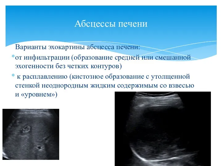 Варианты эхокартины абсцесса печени: от инфильтрации (образование средней или смешанной эхогенности без