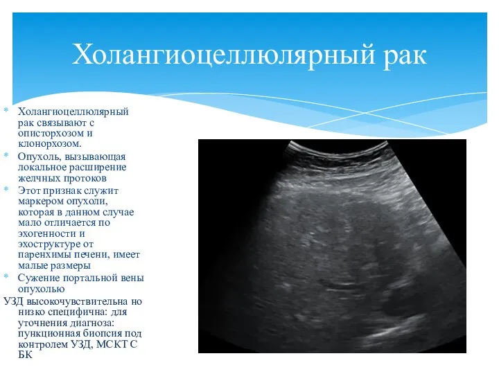 Холангиоцеллюлярный рак связывают с описторхозом и клонорхозом. Опухоль, вызывающая локальное расширение желчных