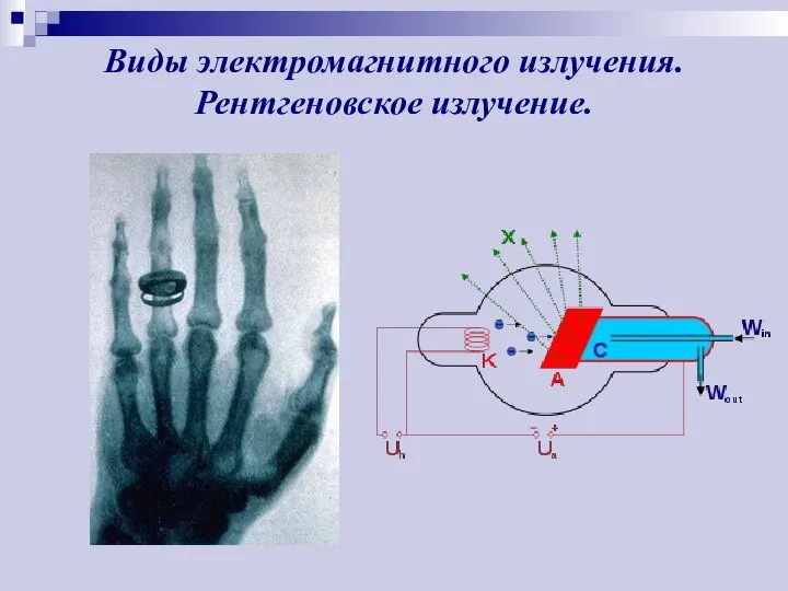 Виды электромагнитного излучения. Рентгеновское излучение.