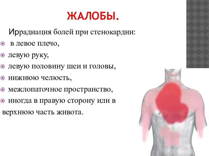 ЖАЛОБЫ. Иррадиация болей при стенокардии: в левое плечо, левую руку, левую половину