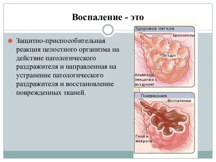 Воспаление - это Защитно-приспособительная реакция целостного организма на действие патологического раздражителя и