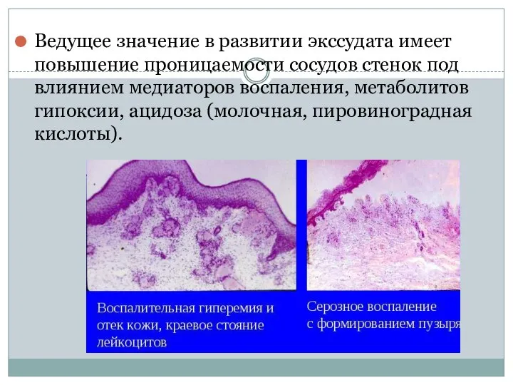 Ведущее значение в развитии экссудата имеет повышение проницаемости сосудов стенок под влиянием