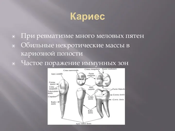 Кариес При ревматизме много меловых пятен Обильные некротические массы в кариозной полости Частое поражение иммунных зон