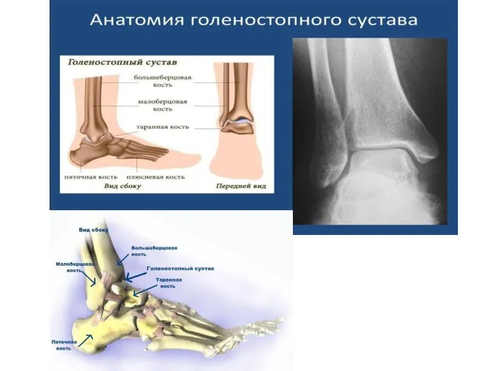 Голеностопный сустав