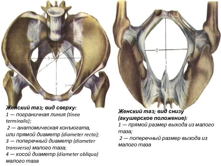 Женский таз; вид сверху: 1 — пограничная линия (tinea terminalis); 2 —