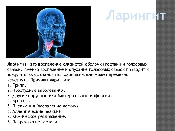 Ларингит Ларингит – это воспаление слизистой оболочки гортани и голосовых связок. Именно