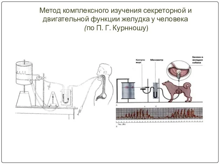 Метод комплексного изучения секреторной и двигательной функции желудка у человека (по П. Г. Курнношу)