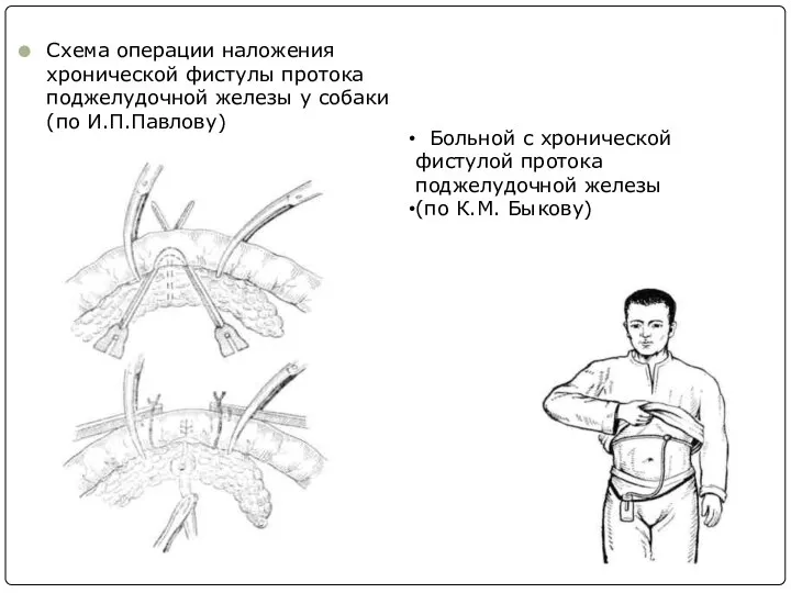 Схема операции наложения хронической фистулы протока поджелудочной железы у собаки (по И.П.Павлову)
