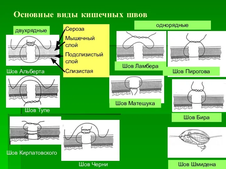 Основные виды кишечных швов Шов Альберта Шов Бира Шов Кирпатовского Шов Ламбера