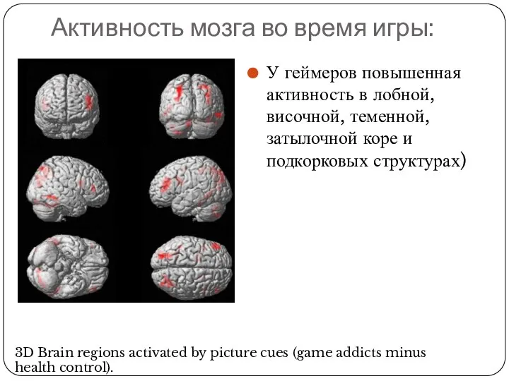 Активность мозга во время игры: У геймеров повышенная активность в лобной, височной,