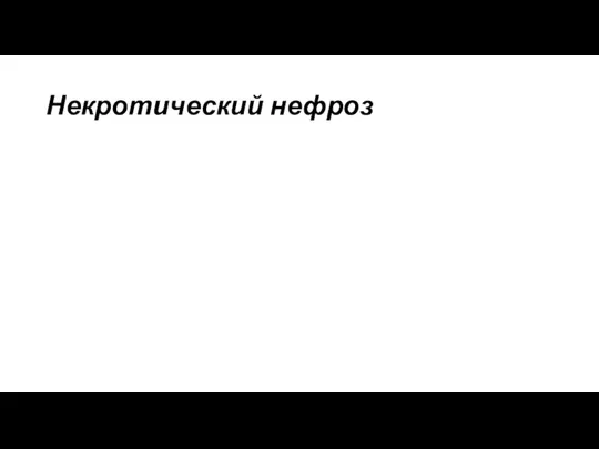 Некротический нефроз