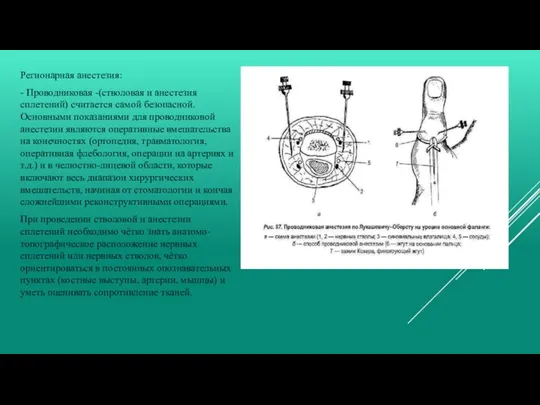 Регионарная анестезия: - Проводниковая -(стволовая и анестезия сплетений) считается самой безопасной. Основными