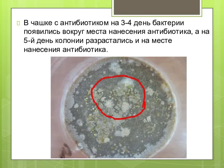 В чашке с антибиотиком на 3-4 день бактерии появились вокруг места нанесения