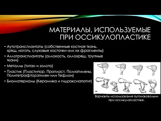 МАТЕРИАЛЫ, ИСПОЛЬЗУЕМЫЕ ПРИ ОССИКУЛОПЛАСТИКЕ Аутотрансплантаты (собственные костная ткань, хрящ, ноготь, слуховые косточки