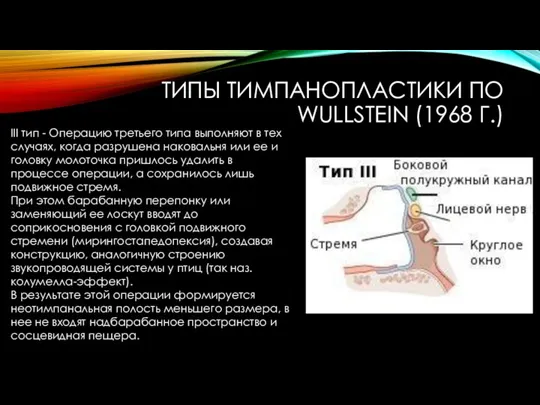 ТИПЫ ТИМПАНОПЛАСТИКИ ПО WULLSTEIN (1968 Г.) III тип - Операцию третьего типа