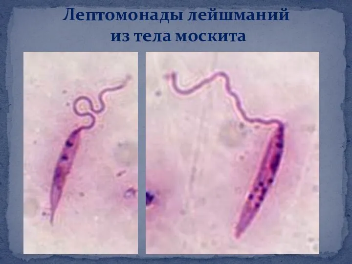 Лептомонады лейшманий из тела москита