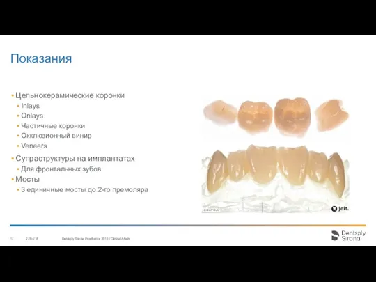 Показания 27/04/18 Dentsply Sirona Prosthetics 2016 / Clinical Affairs Цельнокерамические коронки Inlays