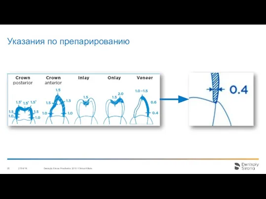 Указания по препарированию 27/04/18 Dentsply Sirona Prosthetics 2016 / Clinical Affairs