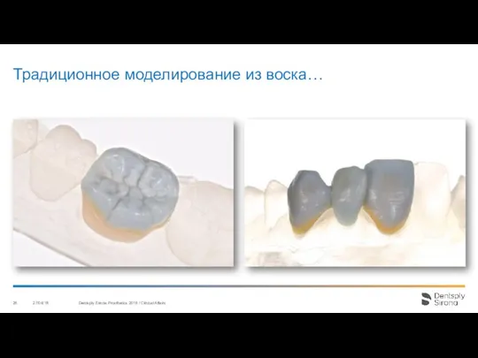 Традиционное моделирование из воска… 27/04/18 Dentsply Sirona Prosthetics 2016 / Clinical Affairs