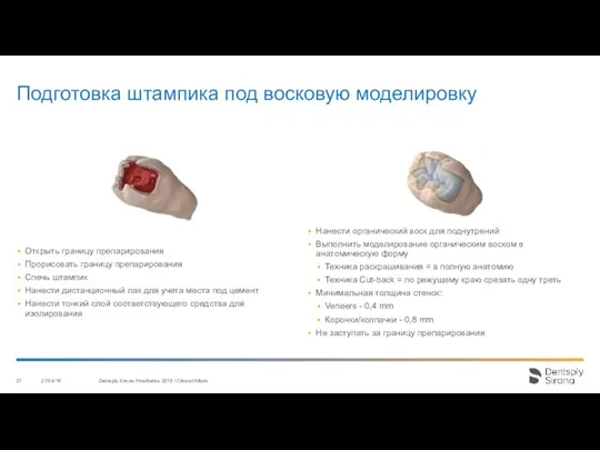 Подготовка штампика под восковую моделировку 27/04/18 Dentsply Sirona Prosthetics 2016 / Clinical