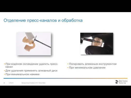 Отделение пресс-каналов и обработка 27/04/18 Dentsply Sirona Prosthetics 2016 / Clinical Affairs