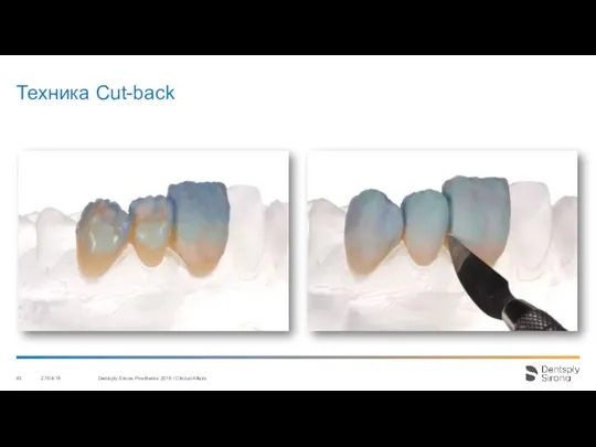 Техника Cut-back 27/04/18 Dentsply Sirona Prosthetics 2016 / Clinical Affairs