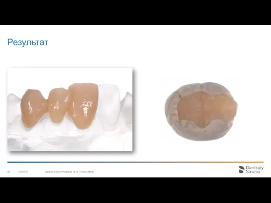 Результат 27/04/18 Dentsply Sirona Prosthetics 2016 / Clinical Affairs