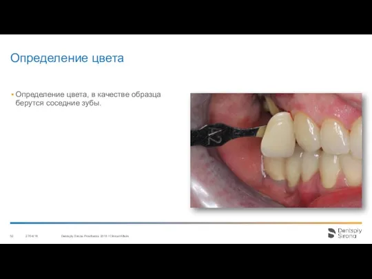 Определение цвета 27/04/18 Dentsply Sirona Prosthetics 2016 / Clinical Affairs Определение цвета,