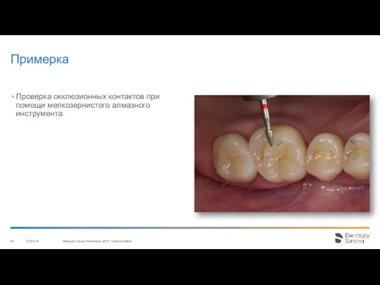 Примерка 27/04/18 Dentsply Sirona Prosthetics 2016 / Clinical Affairs Проверка окклюзионных контактов