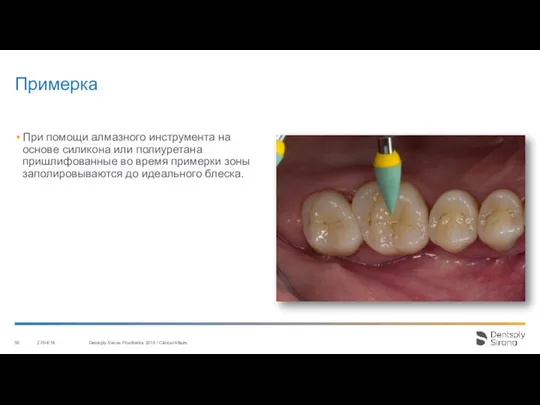 Примерка 27/04/18 Dentsply Sirona Prosthetics 2016 / Clinical Affairs При помощи алмазного