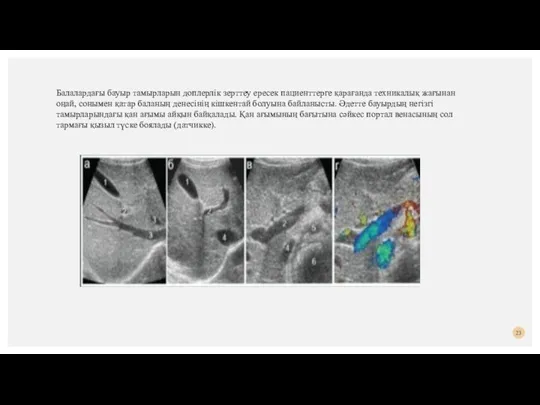 Балалардағы бауыр тамырларын доплерлік зерттеу ересек пациенттерге қарағанда техникалық жағынан оңай, сонымен