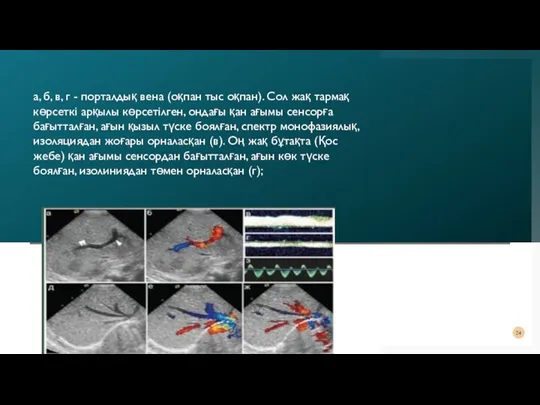 а, б, в, г - порталдық вена (оқпан тыс оқпан). Сол жақ