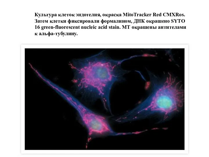 Культура клеток эндотелия, окраска MitoTracker Red CMXRos. Затем клетки фиксировали формалином, ДНК